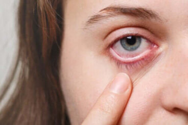 5 remèdes pour le syndrome des yeux secs