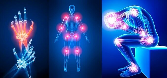 Tout savoir sur les articulations