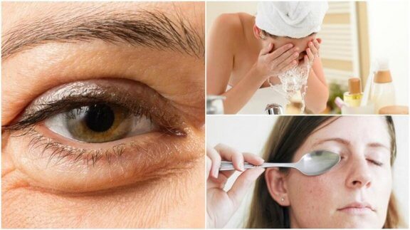 Conseils pour réduire les poches sous les yeux