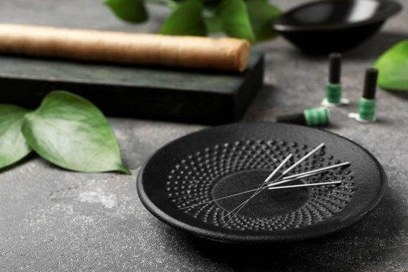 5 bienfaits de l'acupuncture que vous voudrez connaître