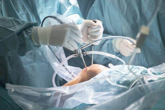 Arthroscopie du genou : quels sont les avantages ?