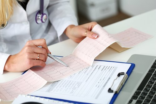 Les 7 étapes pour interpréter un électrocardiogramme