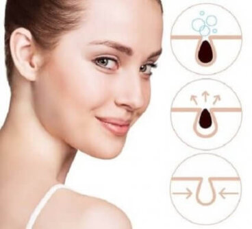 Comment purifier les pores de votre peau avec 3 remèdes