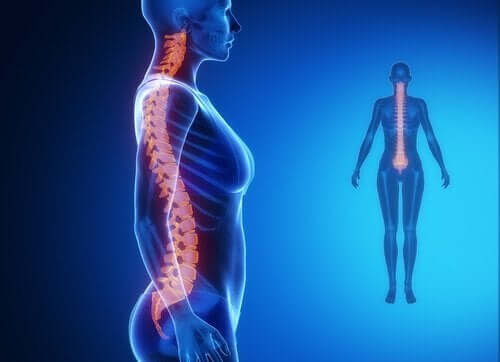 Arthrose de la colonne vertébrale : diagnostic et traitement