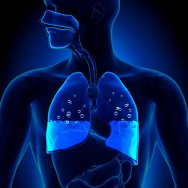 L'œdème pulmonaire : symptômes et causes