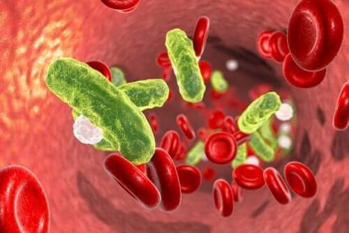 La septicémie urinaire : causes et traitement