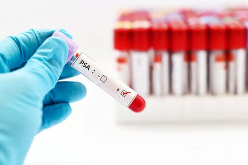 A quoi ressemble un examen de la prostate ?