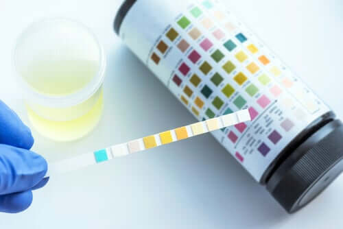 Que détecte une analyse d'urine ?