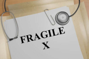 Syndrome de l'X fragile : symptômes et traitements