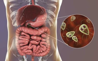 La giardiase : symptômes et traitement