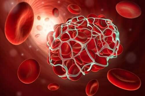 9 aliments pour prévenir la thrombose et l'embolie