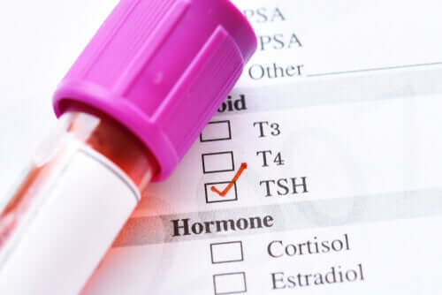 TSH faible : quelles sont les causes ?