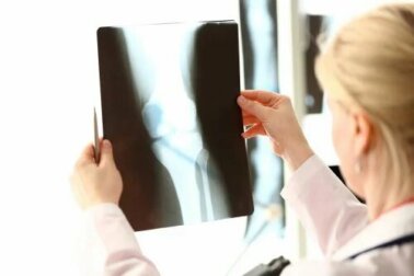 Les aliments contenant du calcium et de la vitamine D pour prendre soin de la santé de vos os