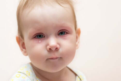 Conjonctivite chez les enfants : que faire ?
