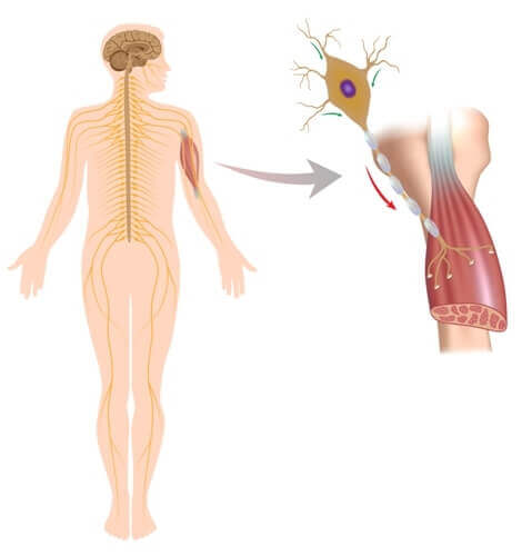 Maladies neuromusculaires : signes et symptômes