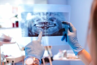 Mâchoire disloquée : causes et traitement