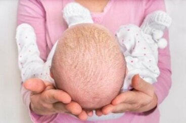 Les traitements de la croûte de lait et de l'acné du nourrisson