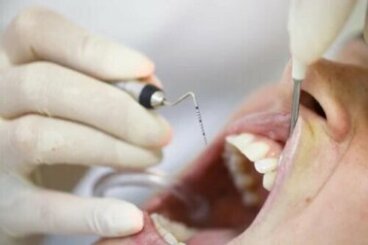 Pyorrhée ou parodontite : qu'est-ce que c'est et comment la traiter ?