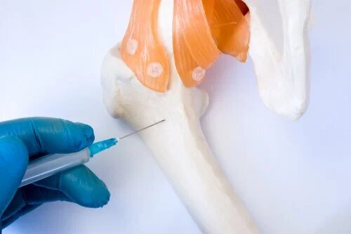 Don de moelle osseuse : en quoi consiste-t-il ?