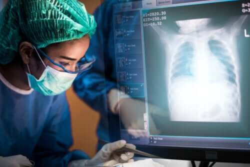 Transplantation pulmonaire : tout ce qu'il faut savoir
