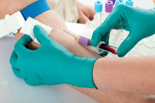 Symptômes et causes de l'hyperkaliémie