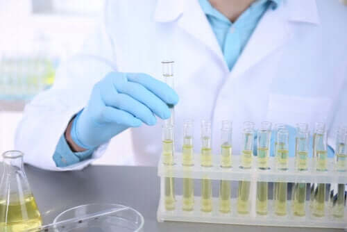 Uroculture : qu'est-ce que c'est et pourquoi l'utilise-t-on ?