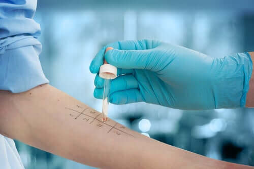 Les tests d'allergie, en quoi consistent-ils ?