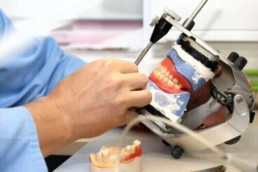 Prothèses sur implants dentaires : qu’est-ce c’est et quels types existe-t-il ?