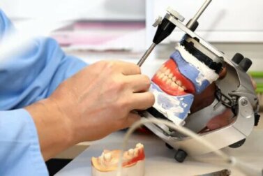 Prothèses sur implants dentaires : qu’est-ce c’est et quels types existe-t-il ?