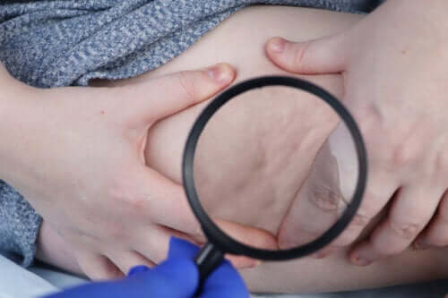 Pourquoi célèbre-t-on la Journée Mondiale de la Lipodystrophie ?