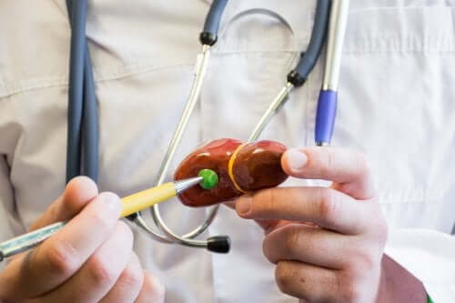 Le lien entre la nutrition et les calculs biliaires