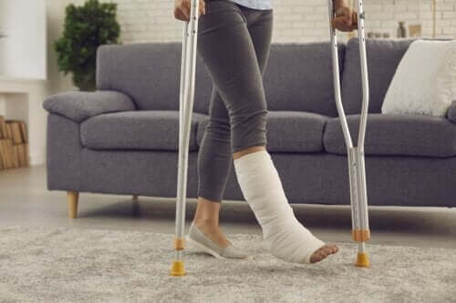 Gypse vs fibre de verre : que choisir pour les fractures ?