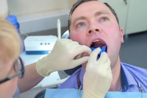 Fluor : comment aide-t-il à prévenir les caries ?