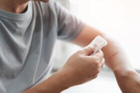 Qu'est-ce que l'exsudat des blessures et pourquoi se produit-il ?
