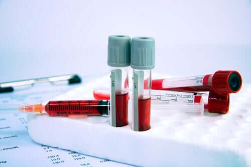 Maladies hématologiques : tout ce que vous devez savoir