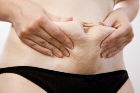 Mommy makeover : caractéristiques et risques
