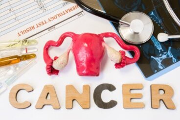 Cancer du col de l'utérus : origine et prévention