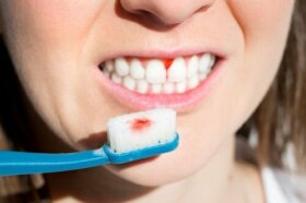 7 conseils pour prévenir la parodontite