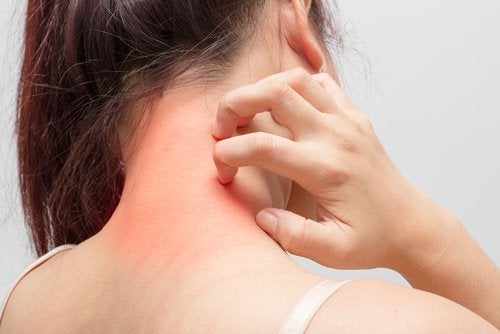 Tout ce que vous devez savoir sur l'eczéma