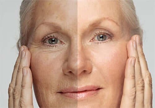 Quel âge a votre peau ? Apprenez à la rajeunir
