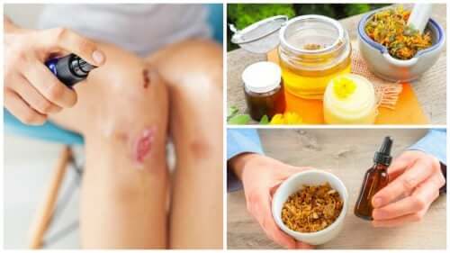 8 ingrédients naturels pour apaiser les plaies cutanées