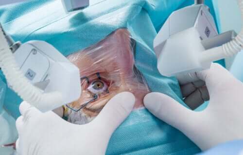 Découvrez les 9 types de chirurgie réfractive et leurs caractéristiques