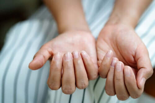 Pourquoi des stries apparaissent-elles sur les ongles ?