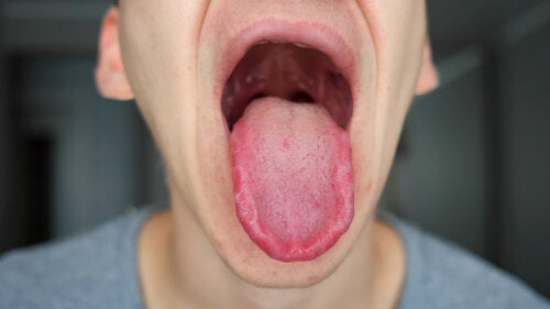 Langue engourdie ? Regardez ces 18 causes possibles