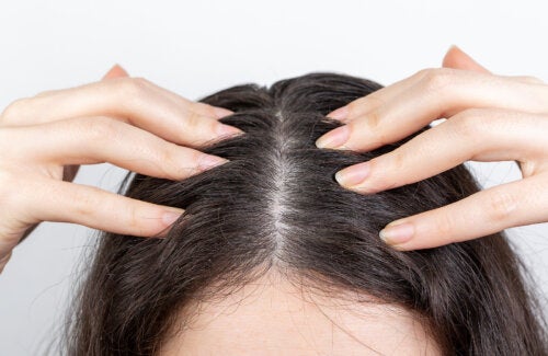Hyperhidrose capillaire : qu'est-ce qui peut aider à la contrôler ?
