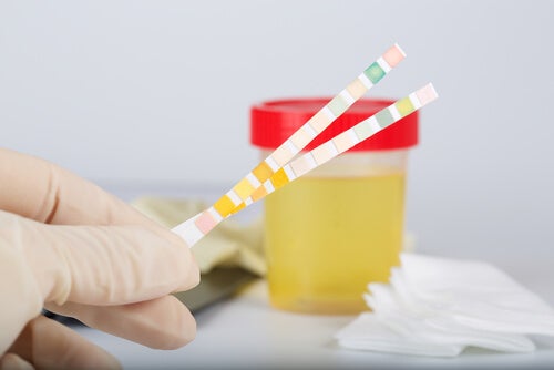 Le pH de l'urine, qu'est-ce que c'est ?
