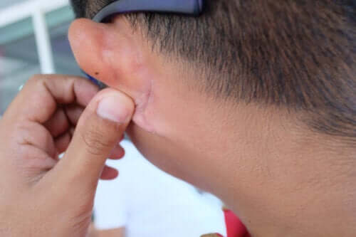 Irritation derrière les oreilles : qu'est-ce qui peut en être la cause ?