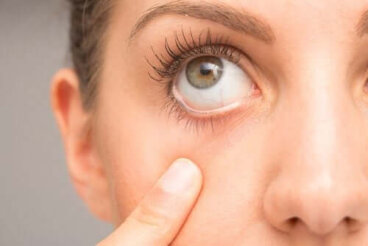 7 conseils pour traiter un tic oculaire