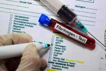 Dosage sanguin du fibrinogène : fonctions et résultats